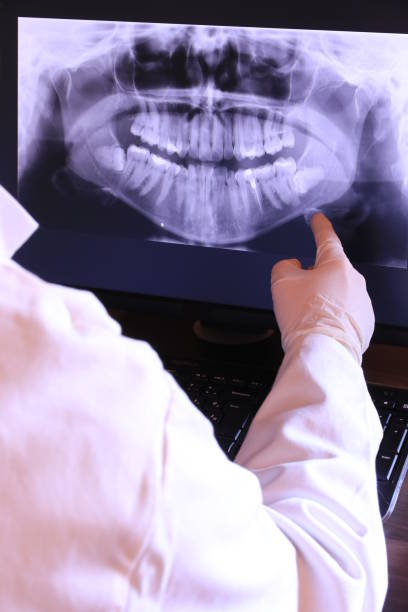 Best Chipped Tooth Repair Near Me  in Santee, CA
