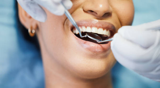 Best Broken Tooth Emergency  in Santee, CA